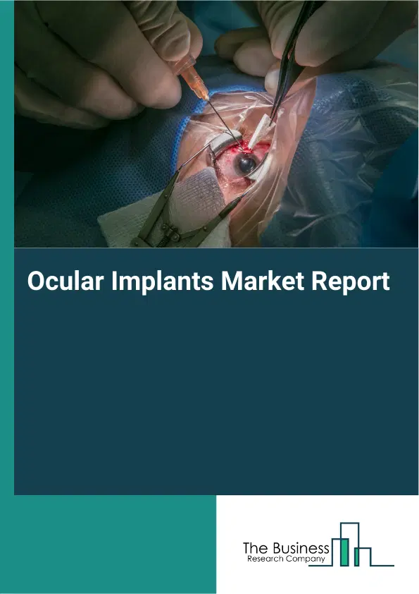 Ocular Implants Market Report 2026 Ocular Implants Market Report 2026