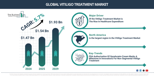 Vitiligo Treatment Global Market Report 2025