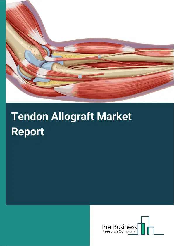 Tendon Allograft Market Report 2026 Tendon Allograft Market Report 2026