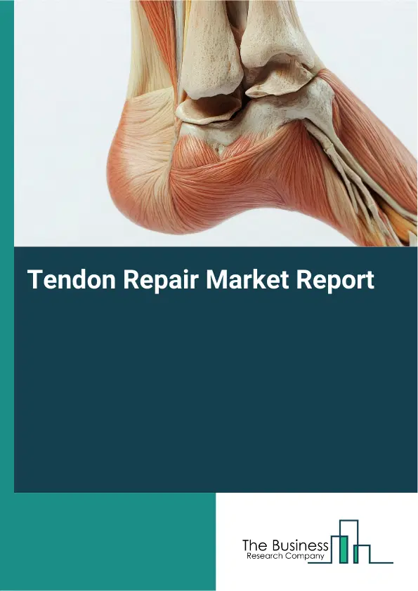 Tendon Repair Market Report 2026 Tendon Repair Market Report 2026