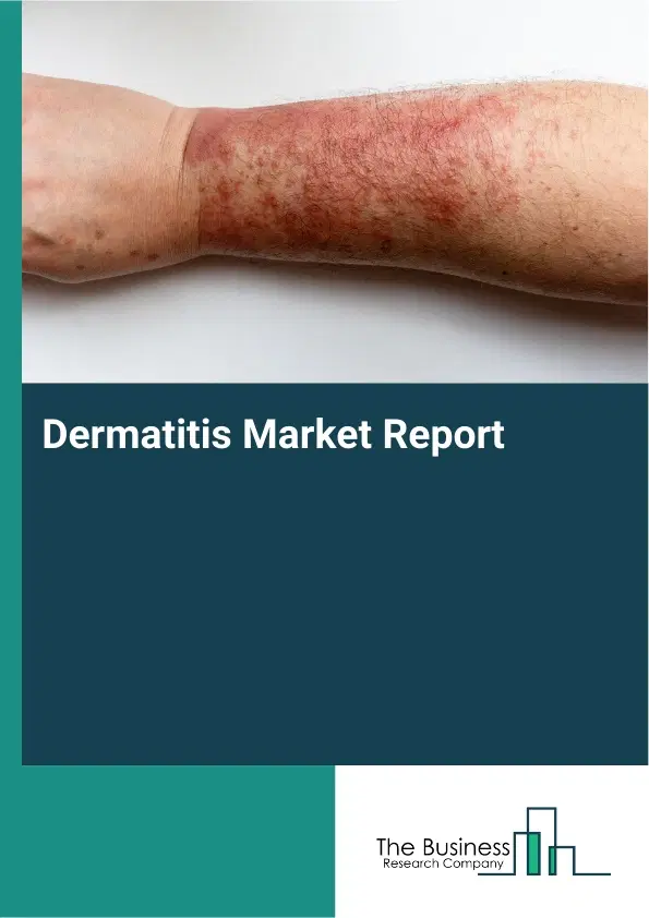 Global Dermatitis Market Report 2026 Global Dermatitis Market Report 2026