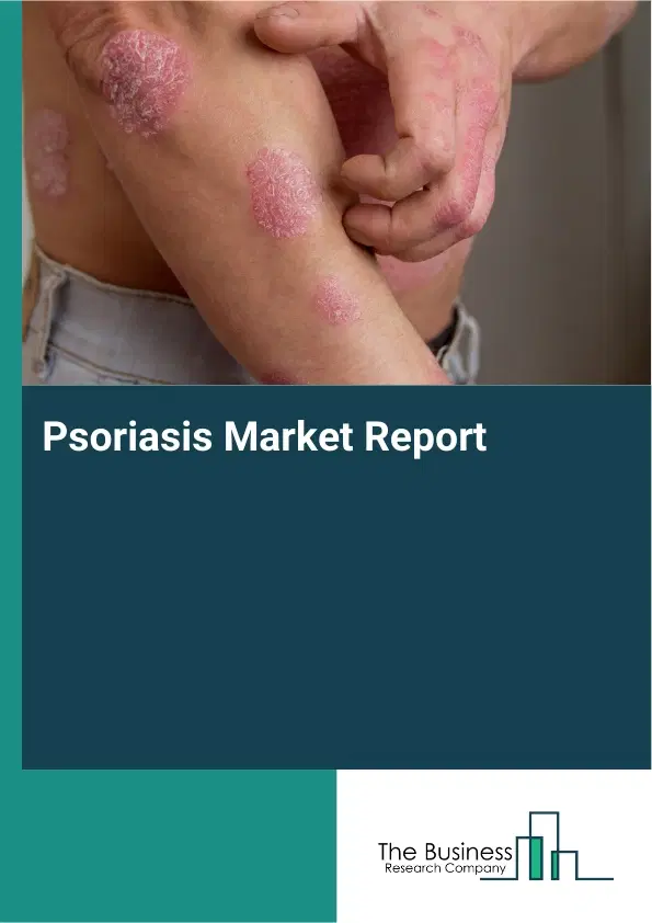 Global Psoriasis Market Report 2026 Global Psoriasis Market Report 2026