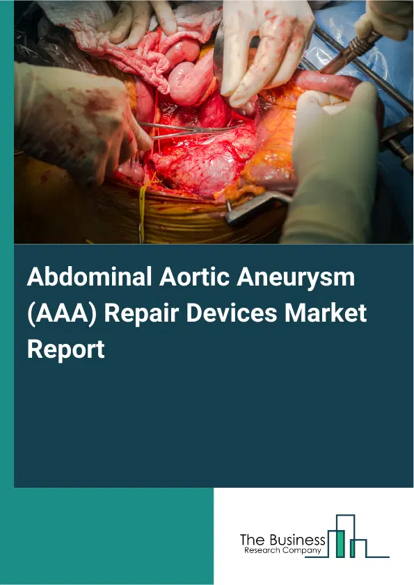 Global Abdominal Aortic Aneurysm (AAA) Repair Devices Market Report 2026 Global Abdominal Aortic Aneurysm (AAA) Repair Devices Market Report 2026