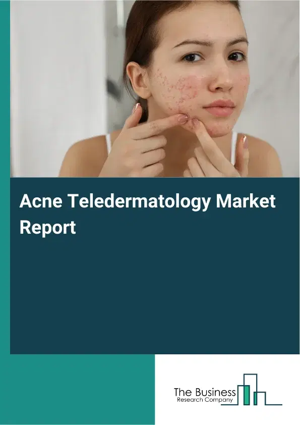Acne Teledermatology Market Report 2026 Acne Teledermatology Market Report 2026