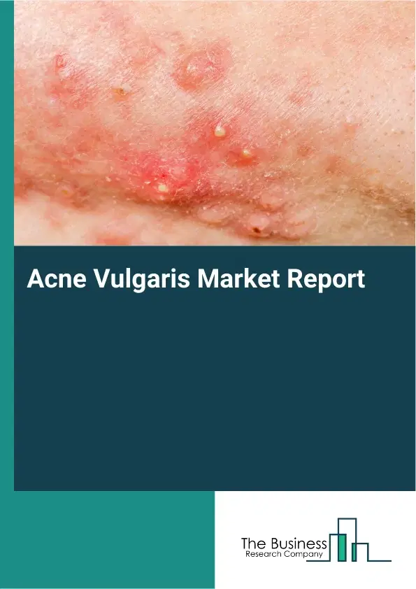 Acne Vulgaris Market Report 2026 Acne Vulgaris Market Report 2026