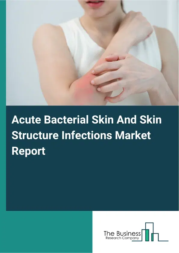 Acute Bacterial Skin And Skin Structure Infections Market Report 2026 Acute Bacterial Skin And Skin Structure Infections Market Report 2026
