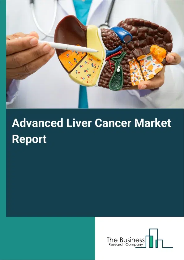 Advanced Liver Cancer Market Report 2026 Advanced Liver Cancer Market Report 2026