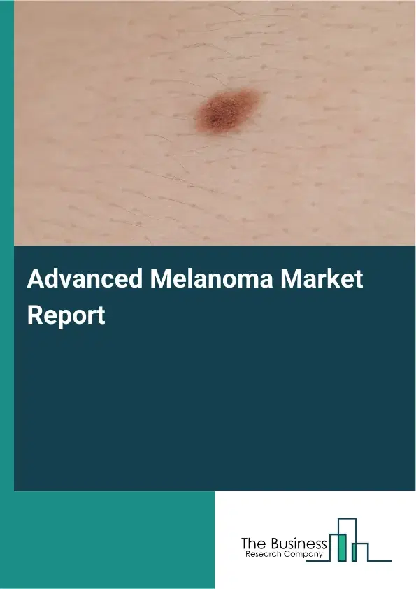 Advanced Melanoma Market Report 2026 Advanced Melanoma Market Report 2026
