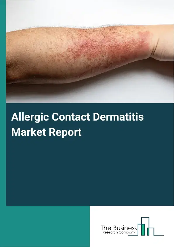 Allergic Contact Dermatitis Market Report 2026 Allergic Contact Dermatitis Market Report 2026