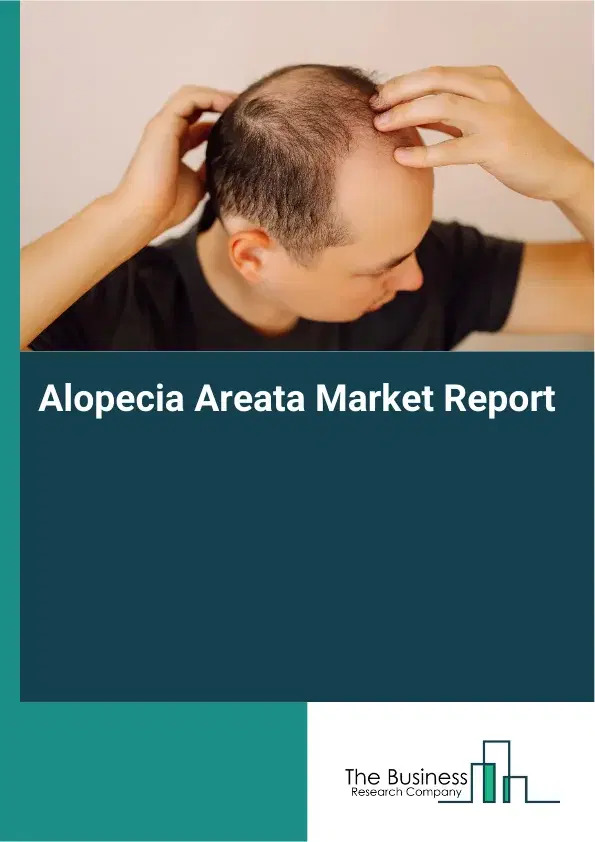 Alopecia Areata Market Report 2026 Alopecia Areata Market Report 2026