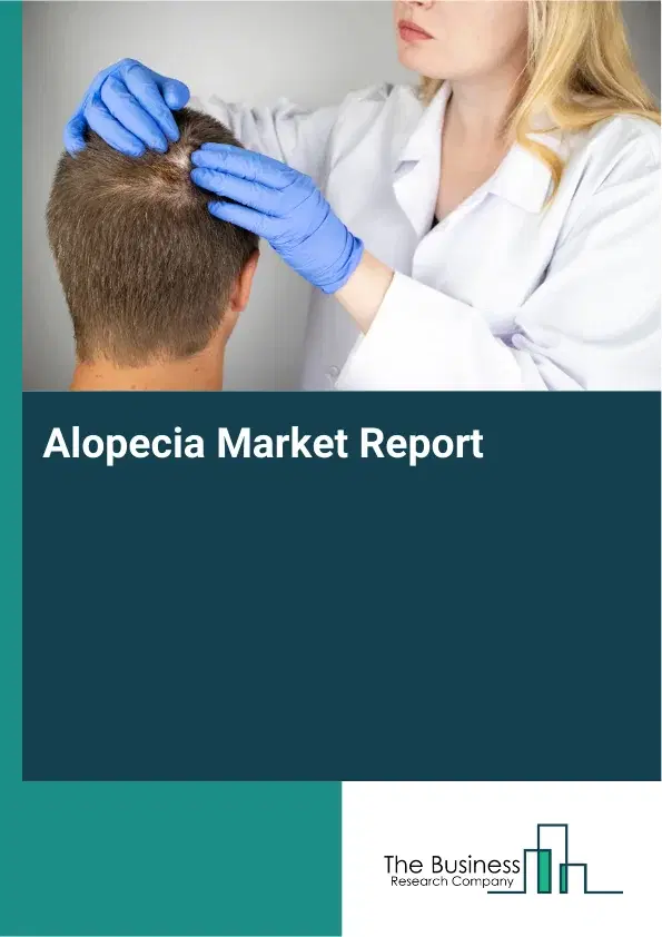 Alopecia Market Report 2026 Alopecia Market Report 2026