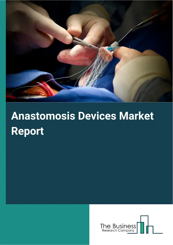 Anastomosis Devices Market Report 2026 Anastomosis Devices Market Report 2026