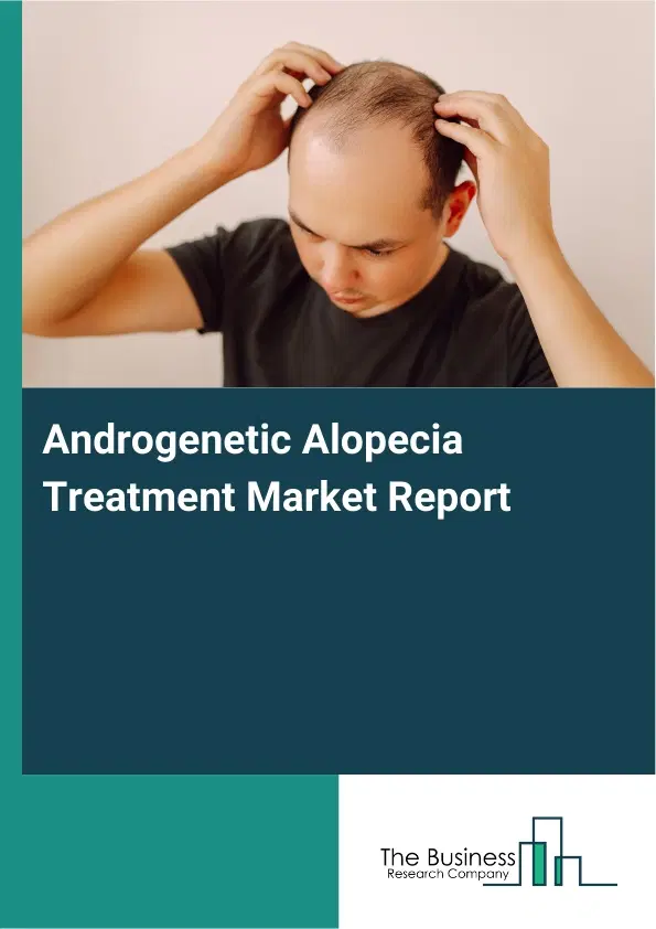 Global Androgenetic Alopecia Treatment Market Report 2026 Global Androgenetic Alopecia Treatment Market Report 2026