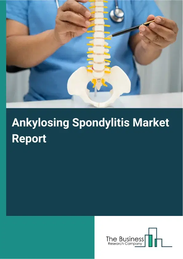 Ankylosing Spondylitis Market Report 2026 Ankylosing Spondylitis Market Report 2026