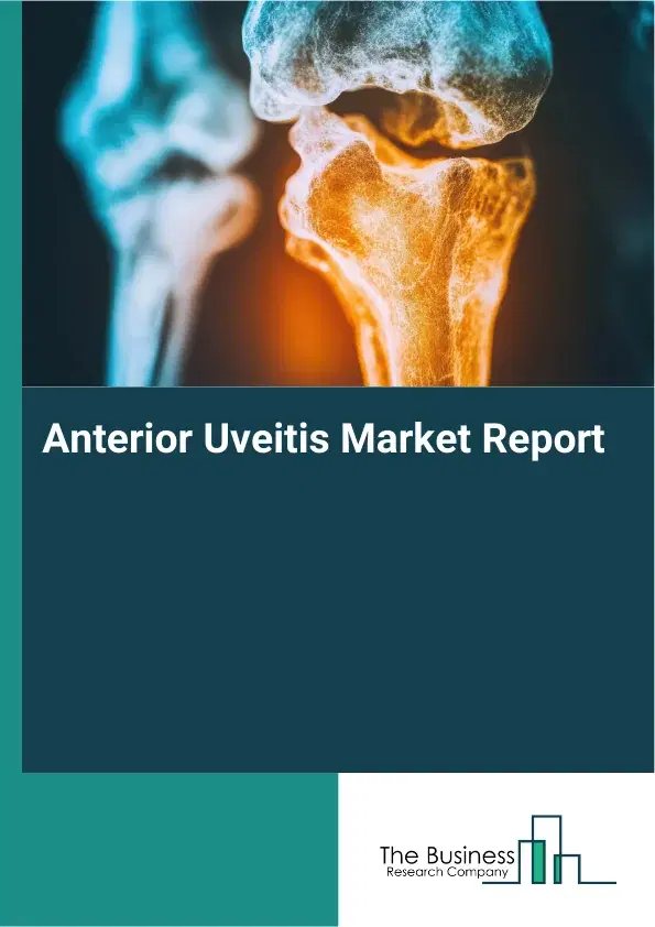 Anterior Uveitis Market Report 2026 Anterior Uveitis Market Report 2026