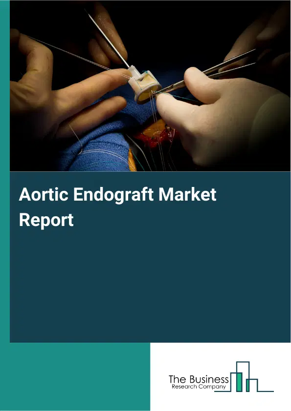 Aortic Endograft Market Report 2026 Aortic Endograft Market Report 2026