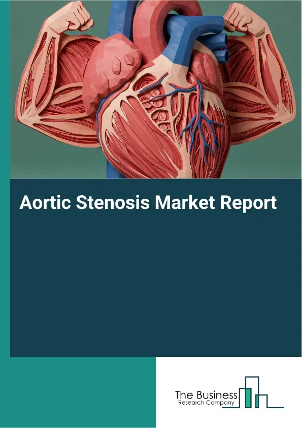 Aortic Stenosis Market Report 2026 Aortic Stenosis Market Report 2026