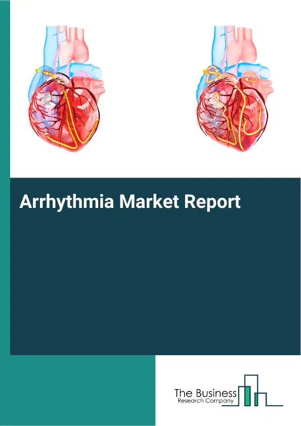 Arrhythmia Market Report 2026 Arrhythmia Market Report 2026