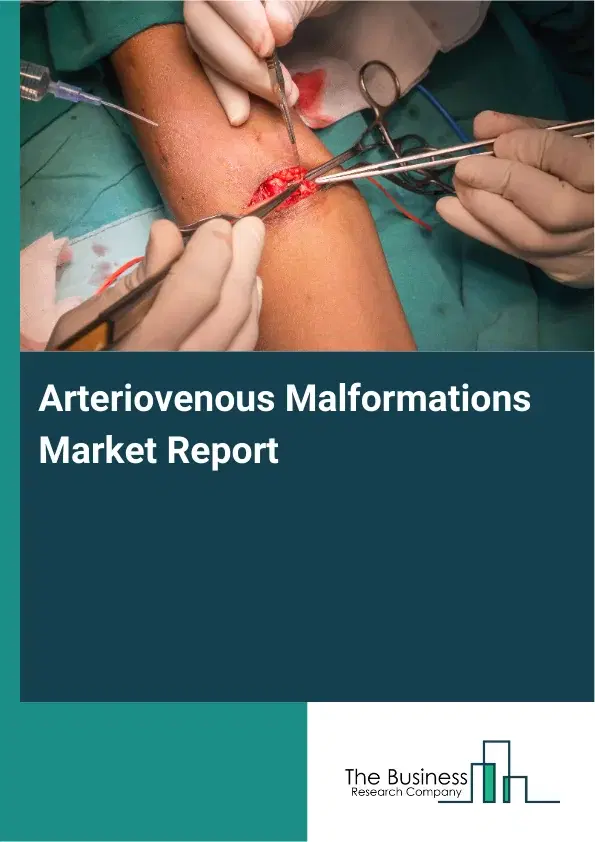Arteriovenous Malformations Market Report 2026 Arteriovenous Malformations Market Report 2026