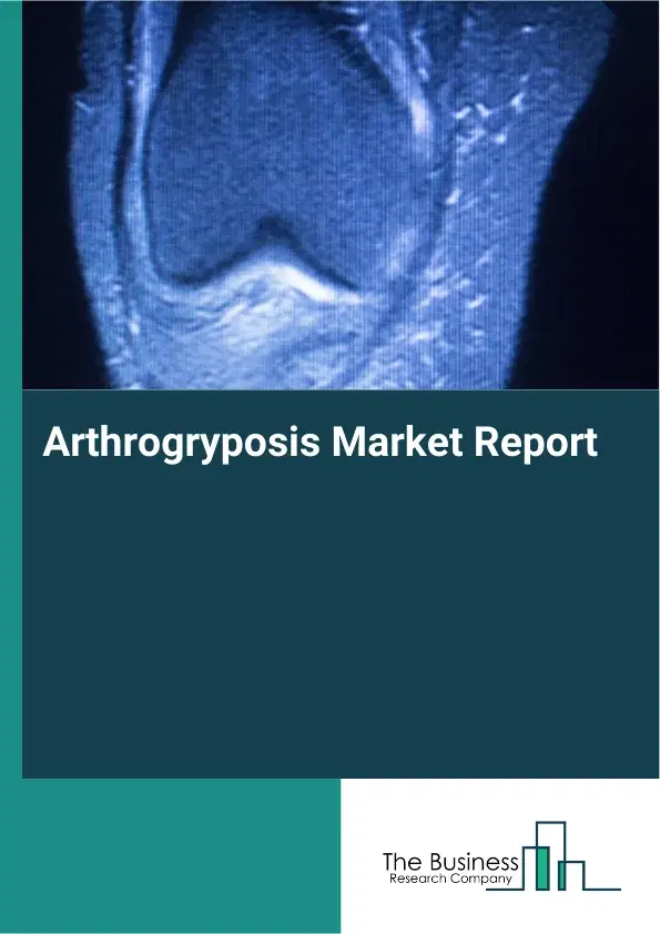Arthrogryposis Market Report 2026 Arthrogryposis Market Report 2026