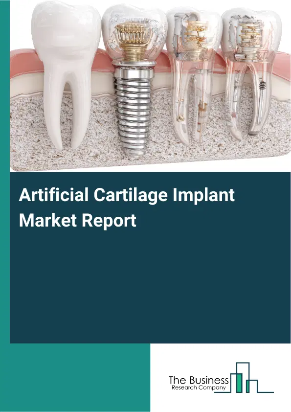 Artificial Cartilage Implant Market Report 2026 Artificial Cartilage Implant Market Report 2026