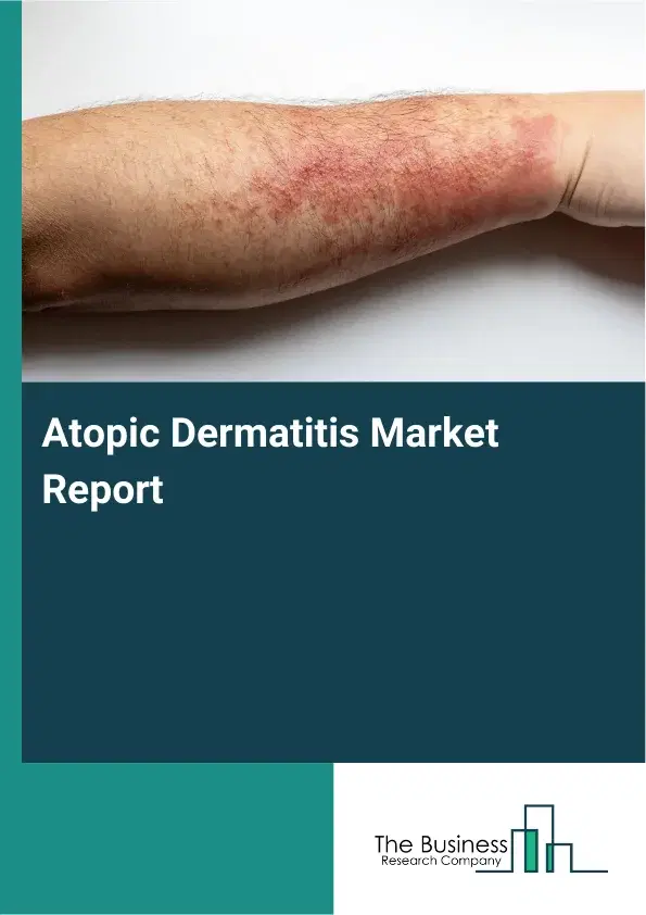 Atopic Dermatitis Market Report 2026 Atopic Dermatitis Market Report 2026