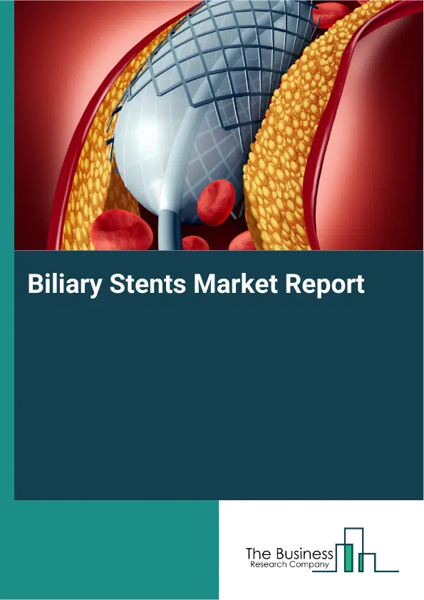 Biliary Stents Market Report 2026 Biliary Stents Market Report 2026