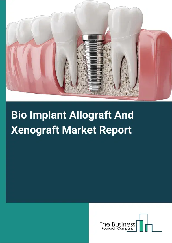 Bio Implant Allograft And Xenograft Market Report 2026 Bio Implant Allograft And Xenograft Market Report 2026