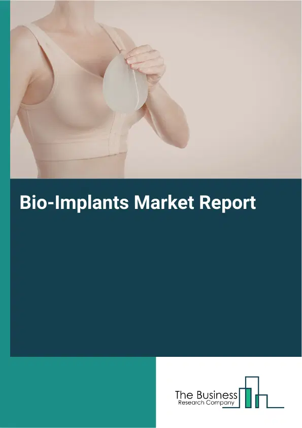 Bio-Implants Market Report 2026 Bio-Implants Market Report 2026