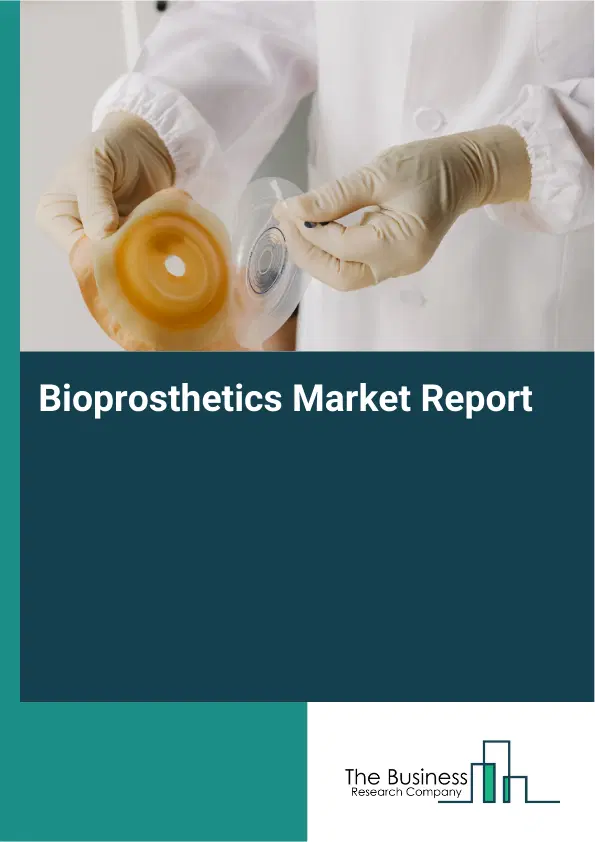 Bioprosthetics Market Report 2026 Bioprosthetics Market Report 2026