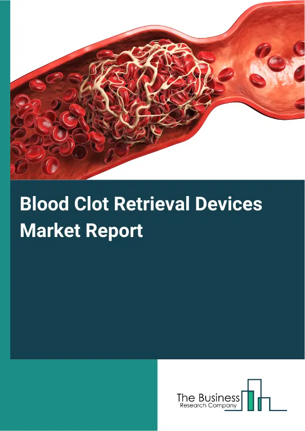 Blood Clot Retrieval Devices Market Report 2026 Blood Clot Retrieval Devices Market Report 2026