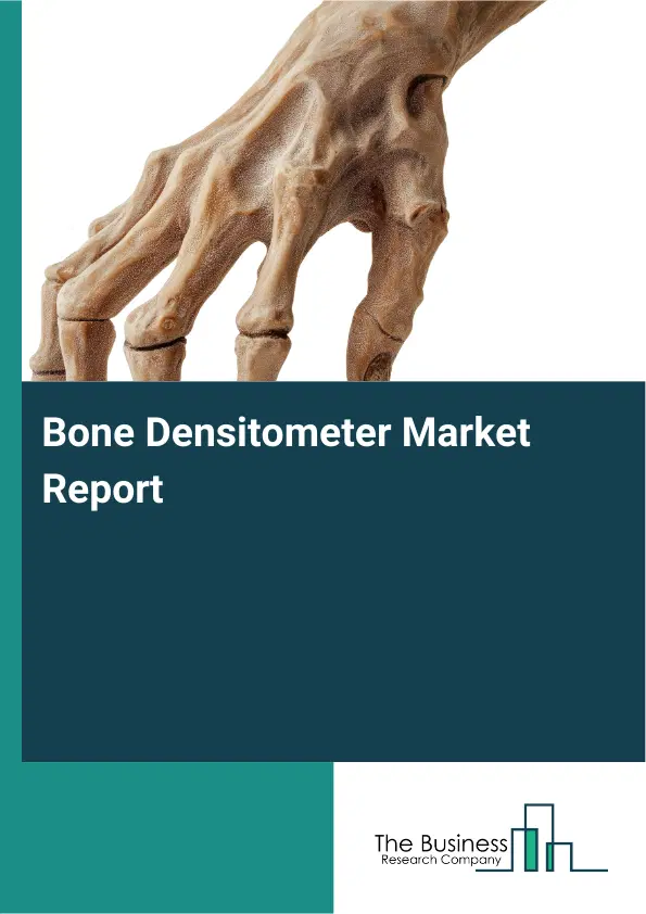 Bone Densitometer Market Report 2026 Bone Densitometer Market Report 2026