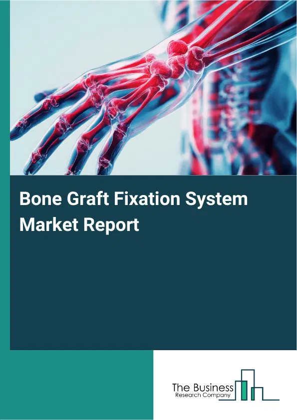 Bone Graft Fixation System Market Report 2026 Bone Graft Fixation System Market Report 2026