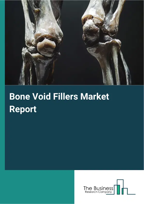 Bone Void Fillers Market Report 2026 Bone Void Fillers Market Report 2026