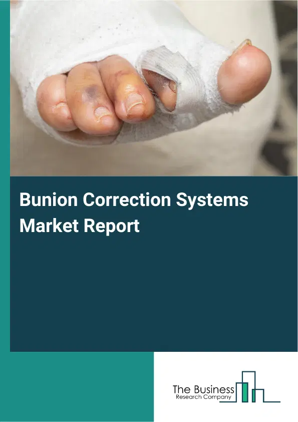 Bunion Correction Systems Market Report 2026 Bunion Correction Systems Market Report 2026