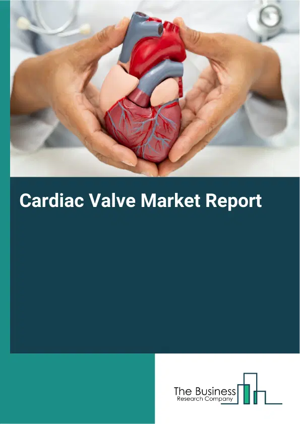 Global Cardiac Valve Market Report 2026 Global Cardiac Valve Market Report 2026