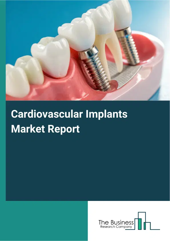 Cardiovascular Implants Market Report 2026 Cardiovascular Implants Market Report 2026