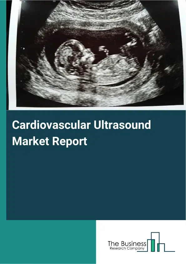 Global Cardiovascular Ultrasound Market Report 2026 Global Cardiovascular Ultrasound Market Report 2026
