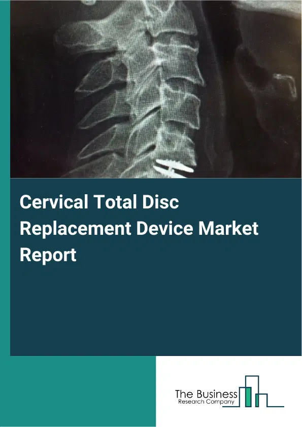 Cervical Total Disc Replacement Device Market Report 2026 Cervical Total Disc Replacement Device Market Report 2026