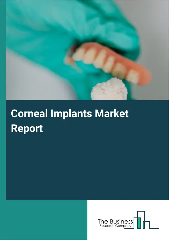 Corneal Implants Market Report 2026 Corneal Implants Market Report 2026