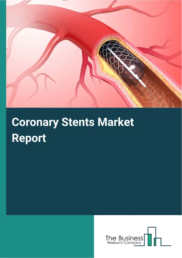 Coronary Stents Market Report 2026 Coronary Stents Market Report 2026