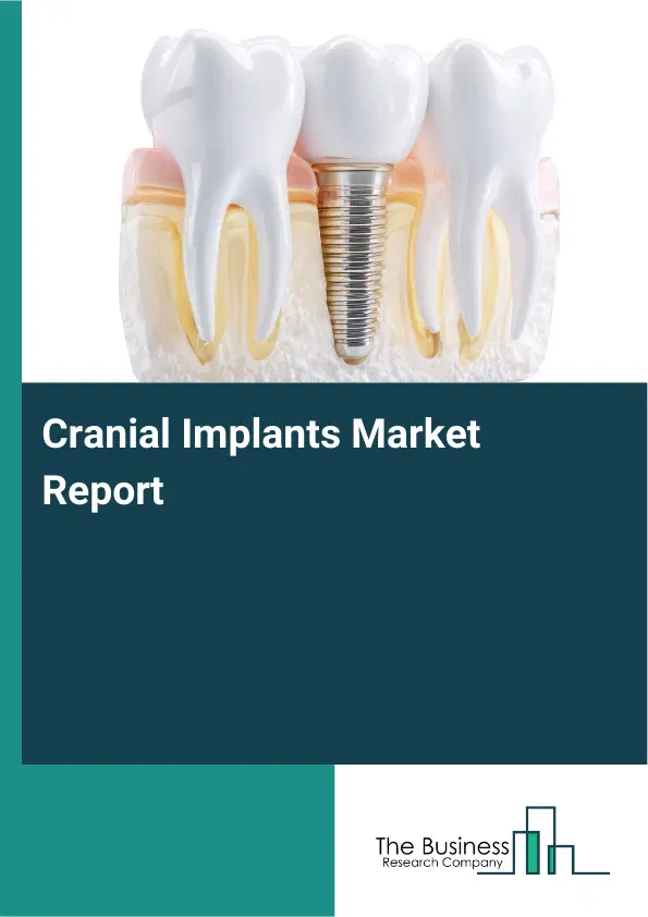 Global Cranial Implants Market Report 2026 Global Cranial Implants Market Report 2026