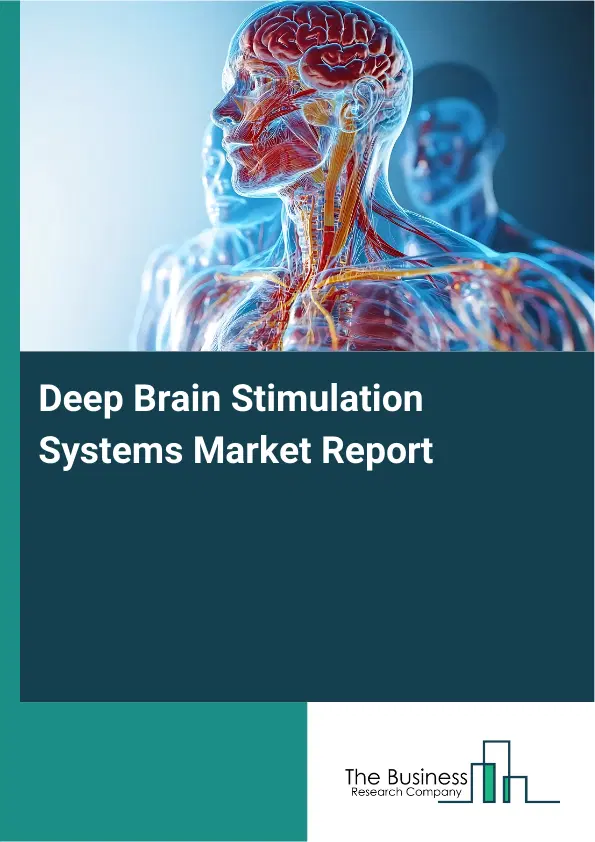Deep Brain Stimulation Systems Market Report 2026 Deep Brain Stimulation Systems Market Report 2026