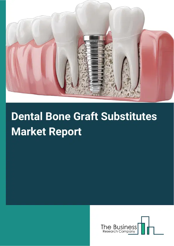 Global Dental Bone Graft Substitutes Market Report 2026 Global Dental Bone Graft Substitutes Market Report 2026