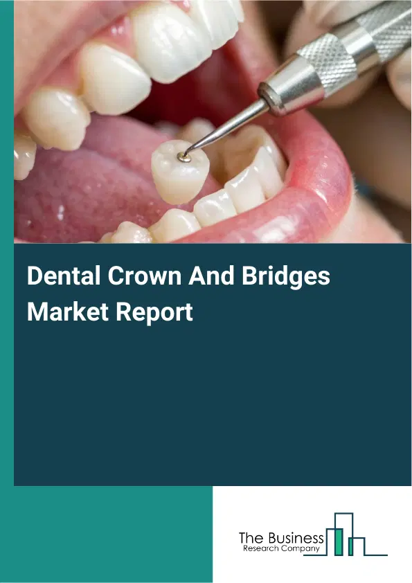Dental Crown And Bridges Market Report 2026 Dental Crown And Bridges Market Report 2026