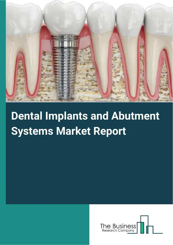 Dental Implants and Abutment Systems Market Report 2026 Dental Implants and Abutment Systems Market Report 2026