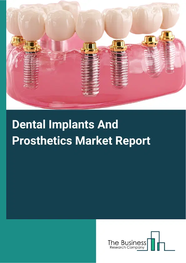 Global Dental Implants And Prosthetics Market Report 2026 Global Dental Implants And Prosthetics Market Report 2026