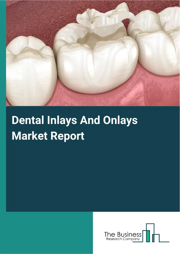 Dental Inlays And Onlays Market Report 2026 Dental Inlays And Onlays Market Report 2026