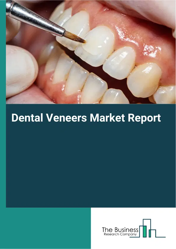 Dental Veneers Market Report 2026 Dental Veneers Market Report 2026
