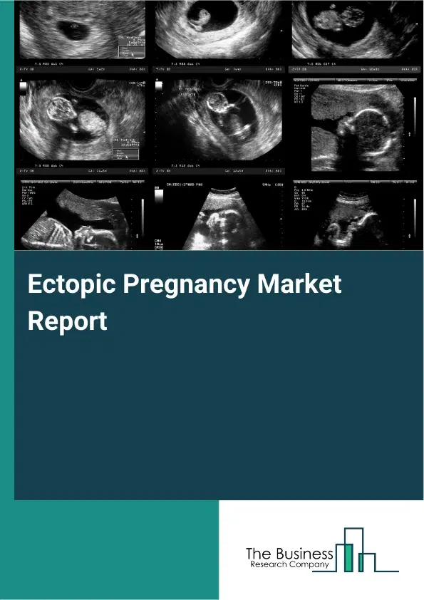 Global Ectopic Pregnancy Market Report 2026 Global Ectopic Pregnancy Market Report 2026